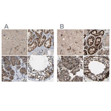 Anti-CYB5R1 antibody produced in rabbit Prestige Antibodies&#174; Powered by Atlas Antibodies, affinity isolated antibody, buffered aqueous glycerol solution