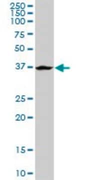 Anti-ADH6 antibody produced in rabbit purified immunoglobulin, buffered aqueous solution