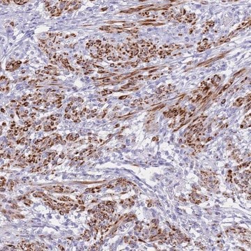 Anti-KCTD15 antibody produced in rabbit Prestige Antibodies&#174; Powered by Atlas Antibodies, affinity isolated antibody, buffered aqueous glycerol solution