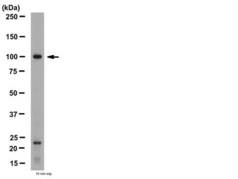 Anticuerpo anti-mGluR4 from rabbit