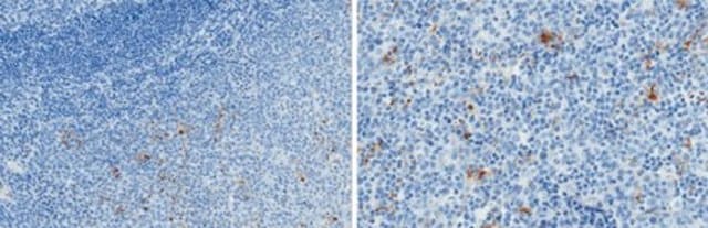 Anti-Properdin Antibody, clone 3A3E1 clone 3A3E1, from mouse