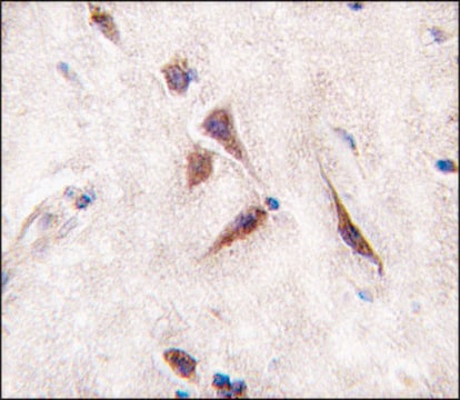 Anti-ALDH6A1 (C-term) antibody produced in rabbit affinity isolated antibody, buffered aqueous solution