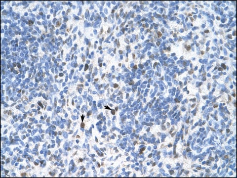 Anti-PCNA IgG fraction of antiserum