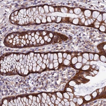 Anti-AP4S1 antibody produced in rabbit Prestige Antibodies&#174; Powered by Atlas Antibodies, affinity isolated antibody, buffered aqueous glycerol solution