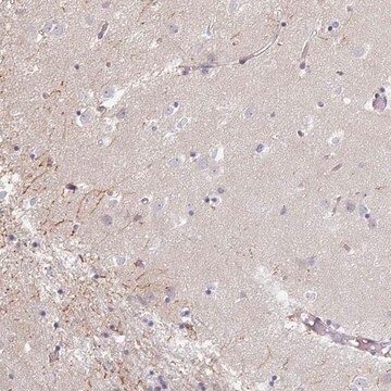 Anti-IP6K3 antibody produced in rabbit Prestige Antibodies&#174; Powered by Atlas Antibodies, affinity isolated antibody, buffered aqueous glycerol solution