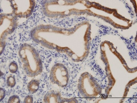 Monoclonal Anti-CPS1 antibody produced in mouse clone 8H8, purified immunoglobulin, buffered aqueous solution