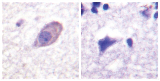 Anti-Kir5.1 antibody produced in rabbit affinity isolated antibody