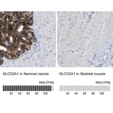 Anti-SLCO2A1 antibody produced in rabbit Prestige Antibodies&#174; Powered by Atlas Antibodies, affinity isolated antibody, buffered aqueous glycerol solution