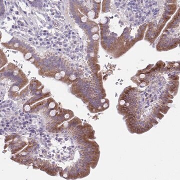 Anti-PLA2G12B antibody produced in rabbit Prestige Antibodies&#174; Powered by Atlas Antibodies, affinity isolated antibody, buffered aqueous glycerol solution