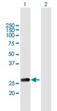 Anti-RAB20 antibody produced in mouse purified immunoglobulin, buffered aqueous solution