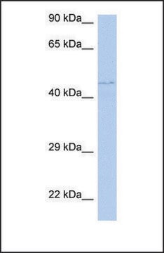 Anti-PAOX antibody produced in rabbit affinity isolated antibody