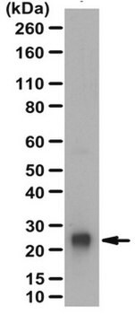 抗蛋白基因产物9.5抗体 from rabbit, purified by affinity chromatography