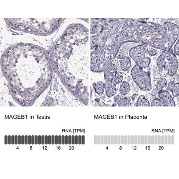 ANTI-MAGEB1 antibody produced in rabbit Ab2, Prestige Antibodies&#174; Powered by Atlas Antibodies, affinity isolated antibody, buffered aqueous glycerol solution