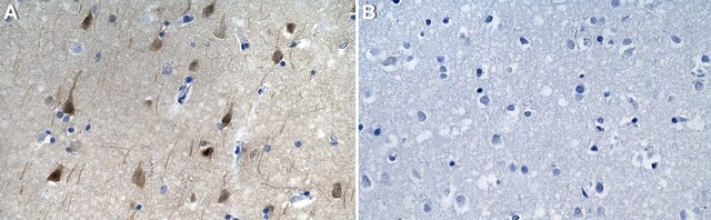 Anti-Cdk5 Antibody, clone 1H13 ZooMAb&#174; Rabbit Monoclonal recombinant, expressed in HEK 293 cells