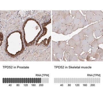 Anti-TPD52 antibody produced in rabbit Prestige Antibodies&#174; Powered by Atlas Antibodies, affinity isolated antibody, buffered aqueous glycerol solution