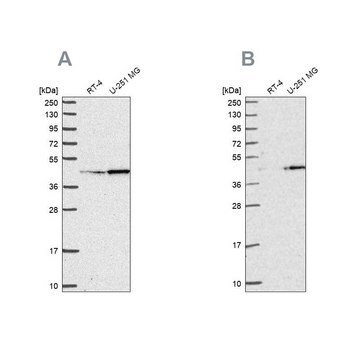 Anti-WDR18 antibody produced in rabbit Prestige Antibodies&#174; Powered by Atlas Antibodies, affinity isolated antibody, buffered aqueous glycerol solution