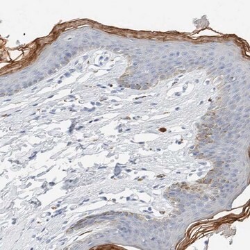 Anti-ALOX12B antibody produced in rabbit Prestige Antibodies&#174; Powered by Atlas Antibodies, affinity isolated antibody, buffered aqueous glycerol solution