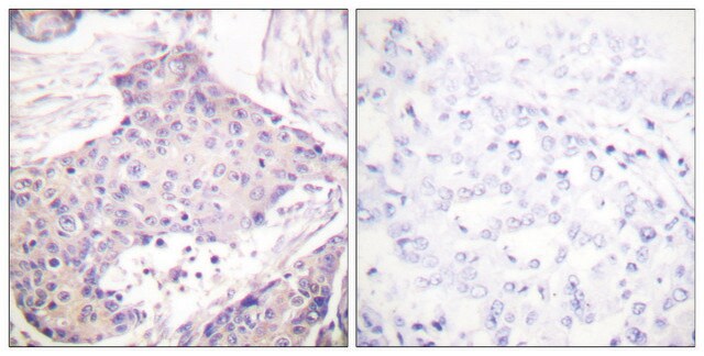 Anti-CARD6 antibody produced in rabbit affinity isolated antibody