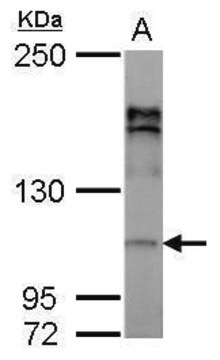 Anti-AP2A2 antibody produced in rabbit affinity isolated antibody, buffered aqueous solution