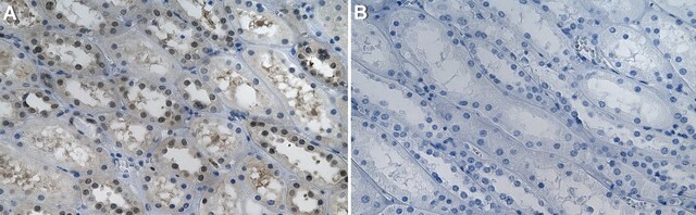 Anti-AIP Antibody, clone 1H8 ZooMAb&#174; Rabbit Monoclonal recombinant, expressed in HEK 293 cells