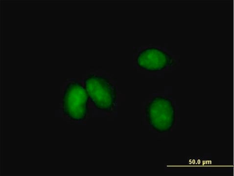 Anti-KCTD18 antibody produced in mouse purified immunoglobulin, buffered aqueous solution