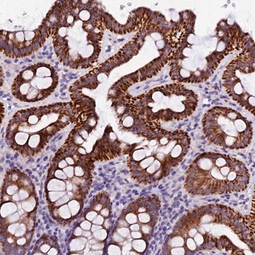 Anti-NAA16 antibody produced in rabbit Prestige Antibodies&#174; Powered by Atlas Antibodies, affinity isolated antibody, buffered aqueous glycerol solution