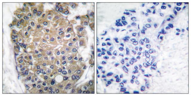 Anti-Keratin 17 antibody produced in rabbit affinity isolated antibody