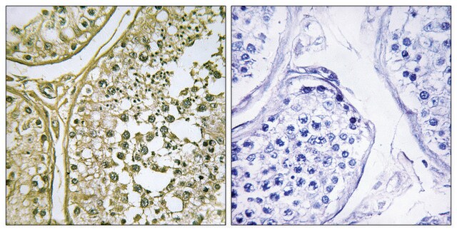 Anti-CKI-&#945;1 antibody produced in rabbit affinity isolated antibody