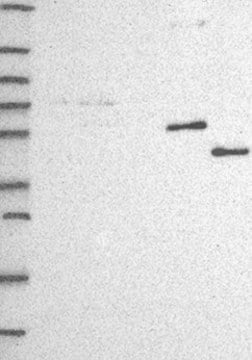 Anti-CYP3A7 antibody produced in rabbit Prestige Antibodies&#174; Powered by Atlas Antibodies, affinity isolated antibody, buffered aqueous glycerol solution