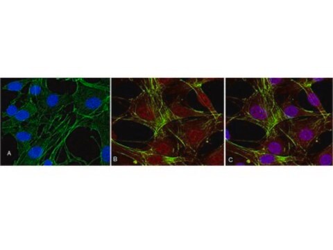 Anticuerpo anti-fosfo-Akt (Thr308), clon 50-1C-25, monoclonal de conejo clone NL50, Upstate&#174;, from rabbit