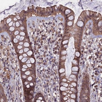 Anti-HUNK antibody produced in rabbit Prestige Antibodies&#174; Powered by Atlas Antibodies, affinity isolated antibody, buffered aqueous glycerol solution