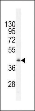 ANTI-RMD1 (N-TERMINAL) antibody produced in rabbit affinity isolated antibody, buffered aqueous solution