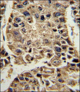 ANTI-SERPINA4 (C-TERM) antibody produced in rabbit IgG fraction of antiserum, buffered aqueous solution