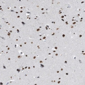 Anti-NUP88 antibody produced in rabbit Prestige Antibodies&#174; Powered by Atlas Antibodies, affinity isolated antibody, buffered aqueous glycerol solution