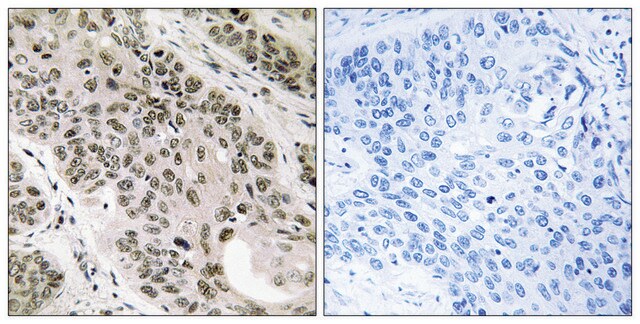 Anti-TNNI3K antibody produced in rabbit affinity isolated antibody