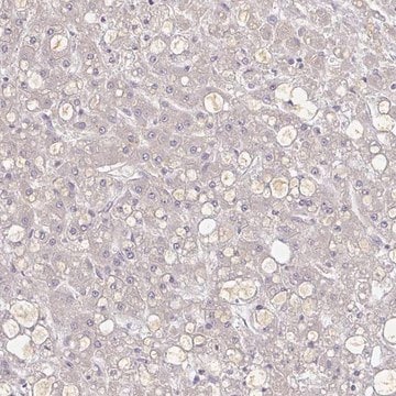 Anti-A1BG antibody produced in rabbit Prestige Antibodies&#174; Powered by Atlas Antibodies, affinity isolated antibody, buffered aqueous glycerol solution