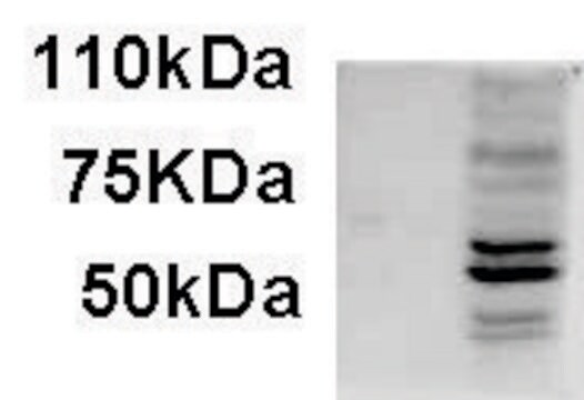 Anti-AIM2 (C-terminal) antibody produced in goat affinity isolated antibody, buffered aqueous solution