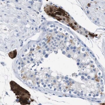 Anti-SLC2A8 antibody produced in rabbit Prestige Antibodies&#174; Powered by Atlas Antibodies, affinity isolated antibody, buffered aqueous glycerol solution