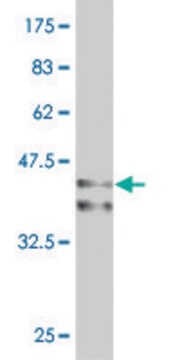 Monoclonal Anti-ARX antibody produced in mouse clone 1B9, purified immunoglobulin, buffered aqueous solution