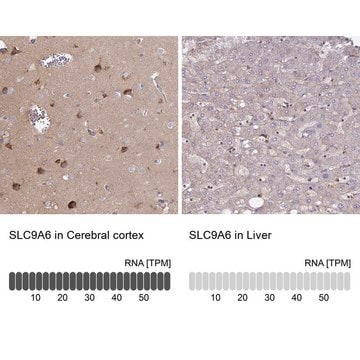 Anti-SLC9A6 antibody produced in rabbit Prestige Antibodies&#174; Powered by Atlas Antibodies, affinity isolated antibody, buffered aqueous glycerol solution