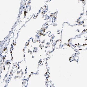 Anti-ABHD3 antibody produced in rabbit Prestige Antibodies&#174; Powered by Atlas Antibodies, affinity isolated antibody, buffered aqueous glycerol solution