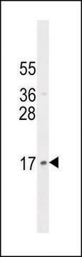 ANTI-LLPH (CENTER) antibody produced in rabbit IgG fraction of antiserum, buffered aqueous solution