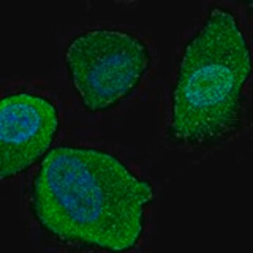 Anti-SLCO4C1 antibody produced in rabbit Prestige Antibodies&#174; Powered by Atlas Antibodies, affinity isolated antibody, buffered aqueous glycerol solution