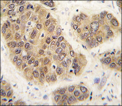 Anti-SUMO4 (M55 Wild type) antibody produced in rabbit saturated ammonium sulfate (SAS) precipitated, buffered aqueous solution