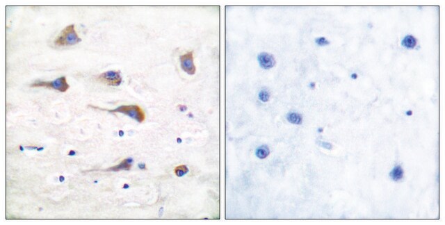 Anti-MGLUR6 antibody produced in rabbit affinity isolated antibody