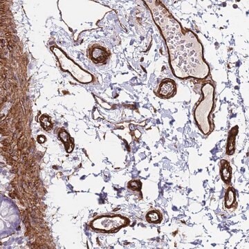 Anti-FAM198A antibody produced in rabbit Prestige Antibodies&#174; Powered by Atlas Antibodies, affinity isolated antibody, buffered aqueous glycerol solution