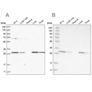 Anti-PROSC antibody produced in rabbit Prestige Antibodies&#174; Powered by Atlas Antibodies, affinity isolated antibody, buffered aqueous glycerol solution, Ab2