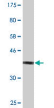 Monoclonal Anti-TSC2 antibody produced in mouse clone 1C1, purified immunoglobulin, buffered aqueous solution