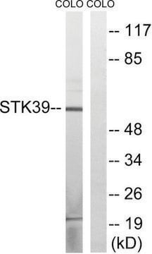 Anti-STK39 antibody produced in rabbit affinity isolated antibody