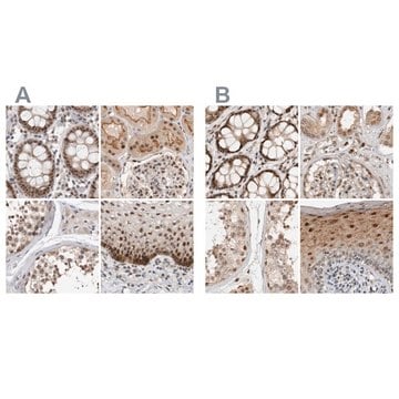 Anti-ZNF521 antibody produced in rabbit Prestige Antibodies&#174; Powered by Atlas Antibodies, affinity isolated antibody, buffered aqueous glycerol solution, Ab1